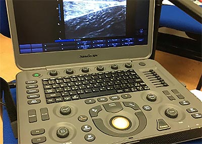 Diagnostic ultrasound